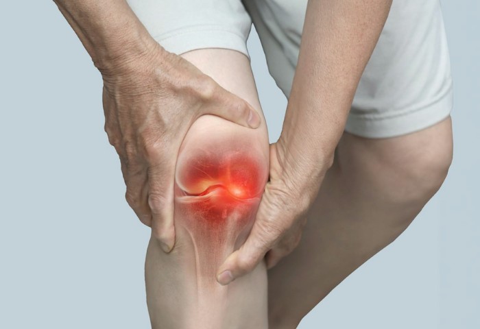 Joint Pain / Arthritis