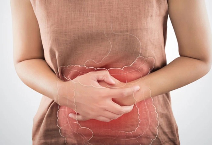 IBS / Colitis