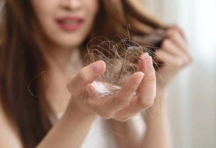 Hairfall / Dandruff