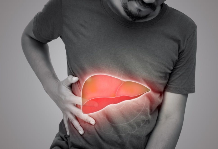 Liver Disorders